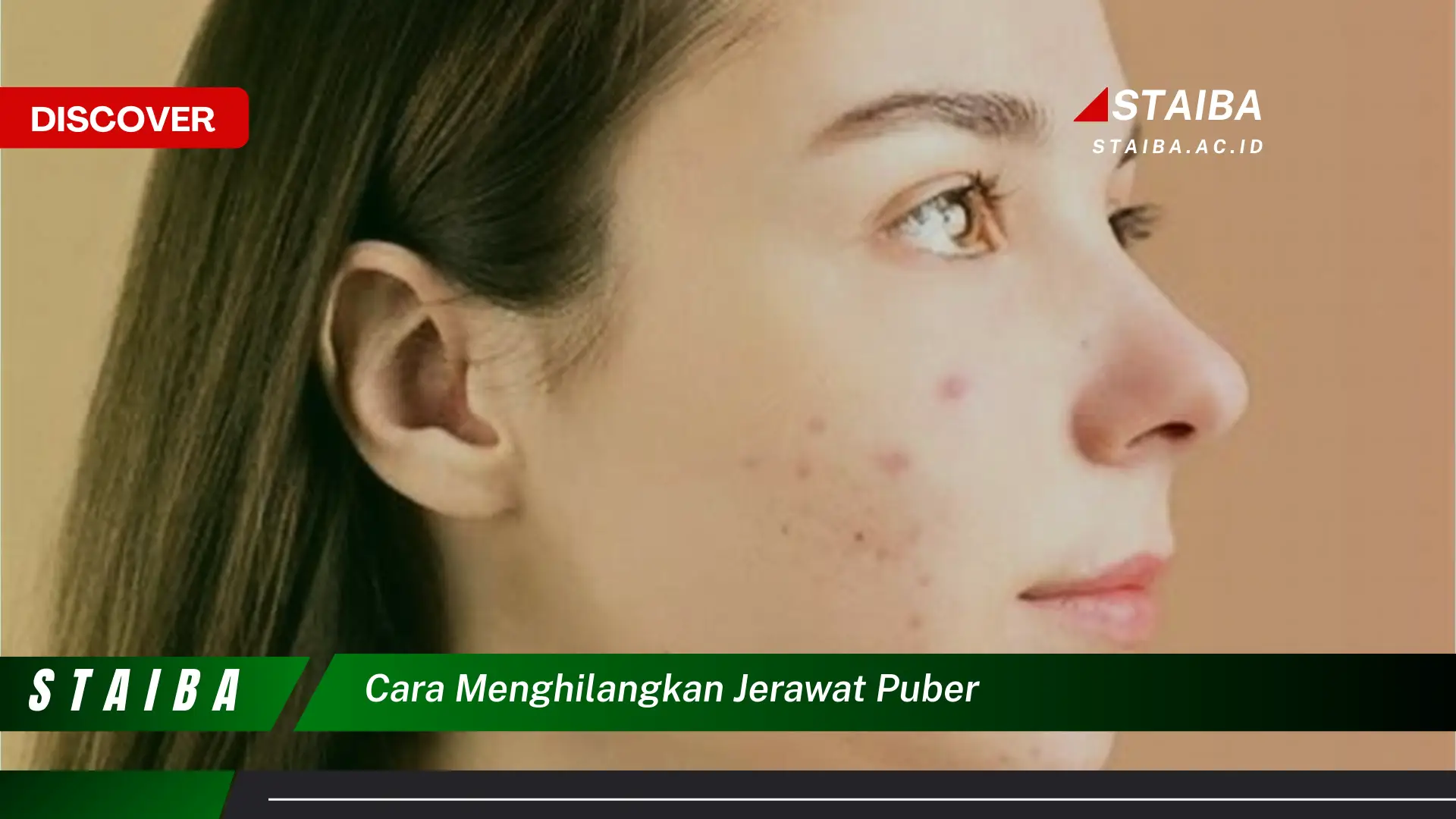 cara menghilangkan jerawat puber