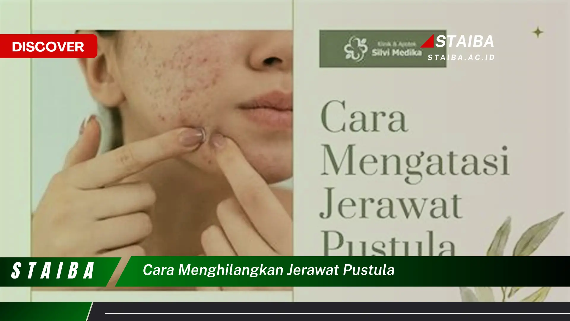 cara menghilangkan jerawat pustula