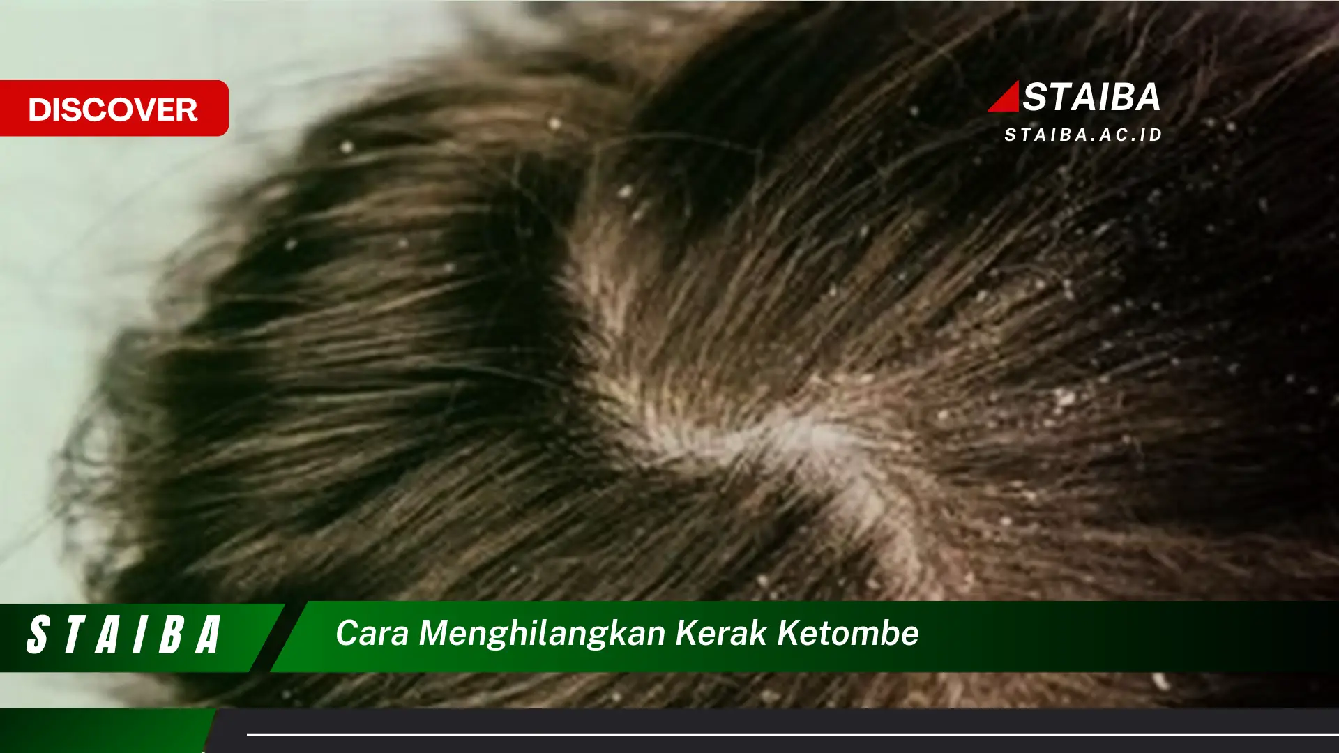 cara menghilangkan kerak ketombe