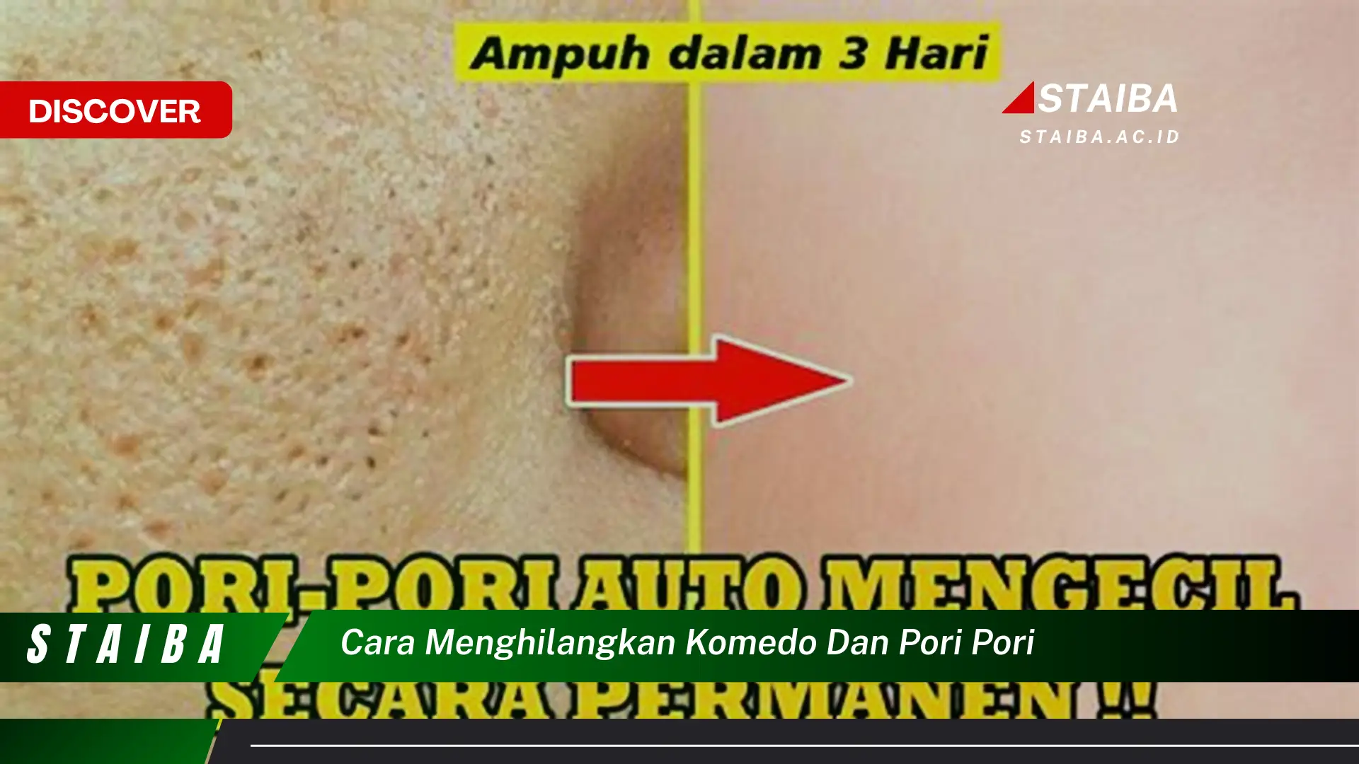 cara menghilangkan komedo dan pori pori