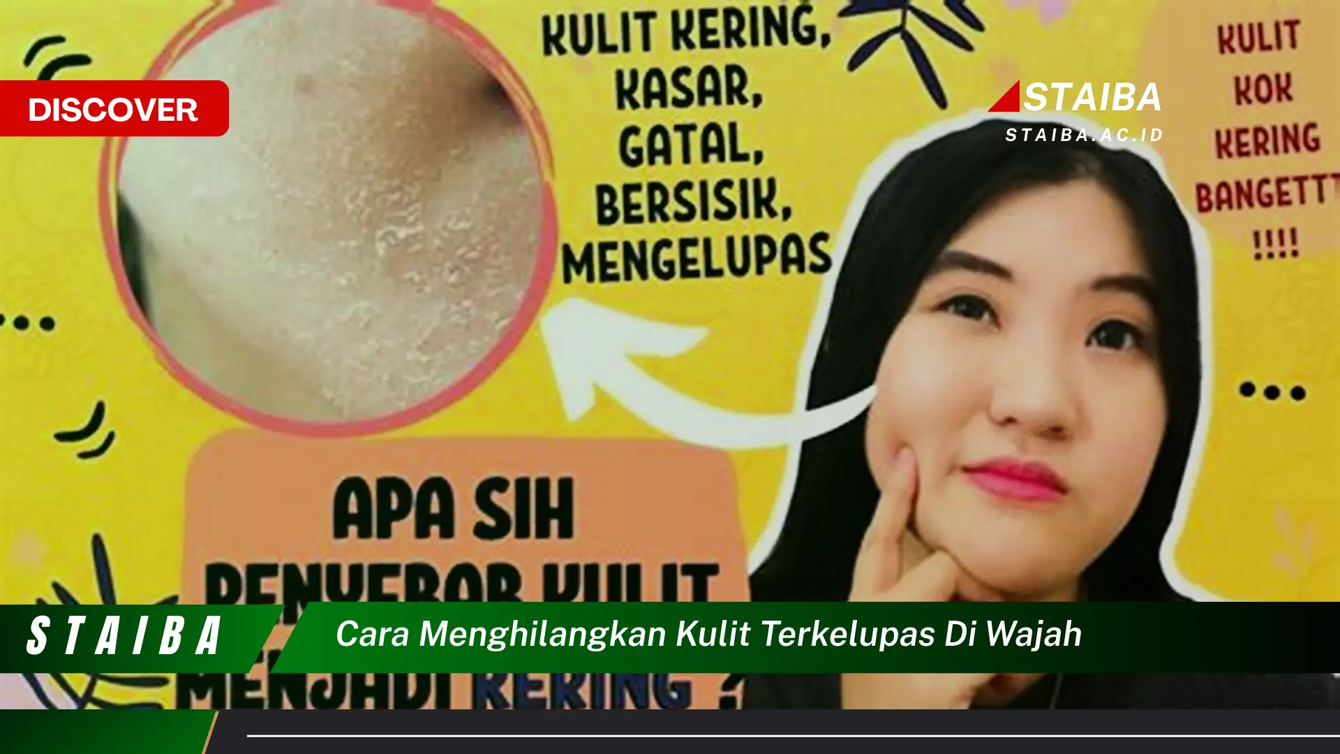 cara menghilangkan kulit terkelupas di wajah