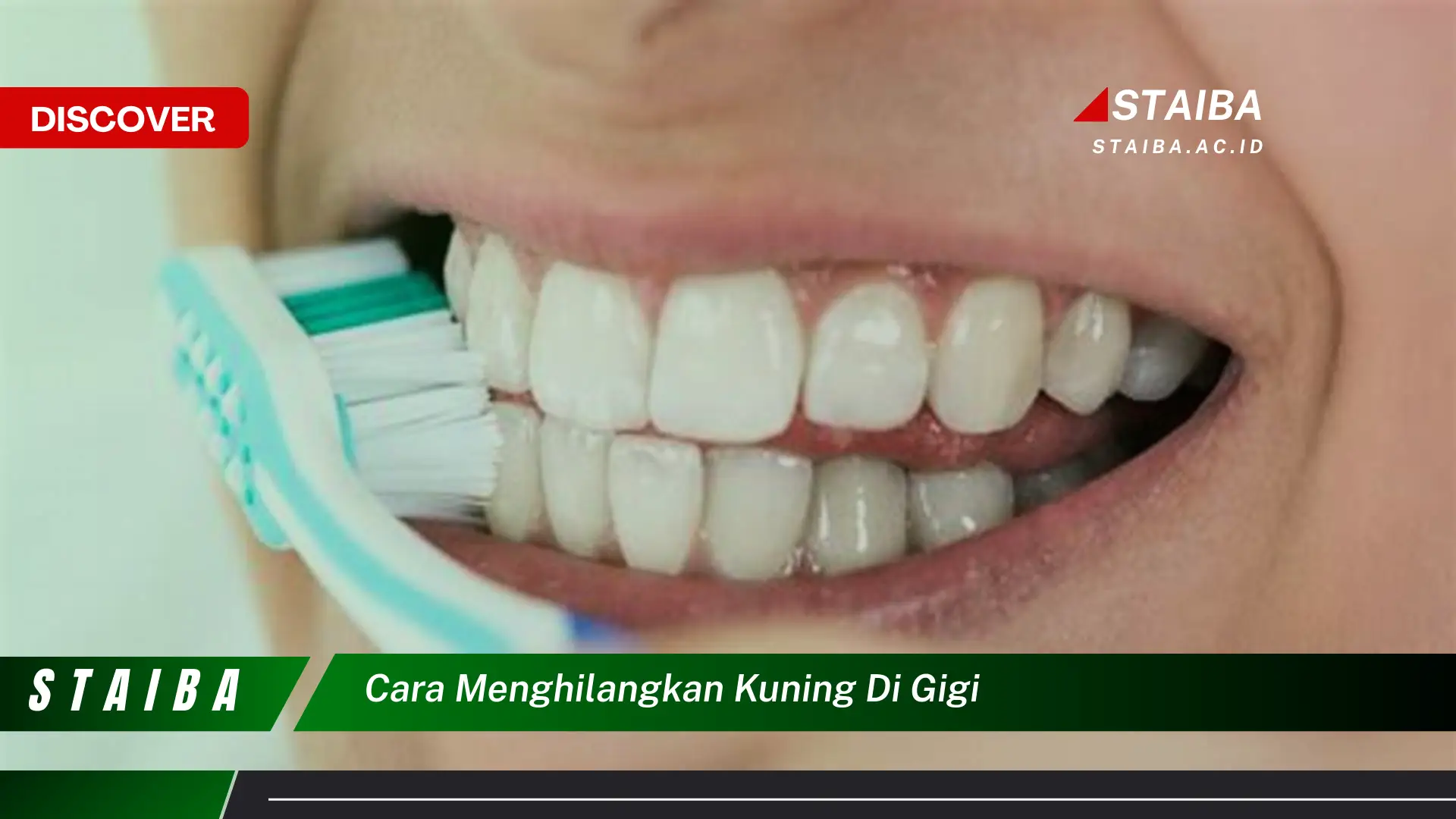 cara menghilangkan kuning di gigi