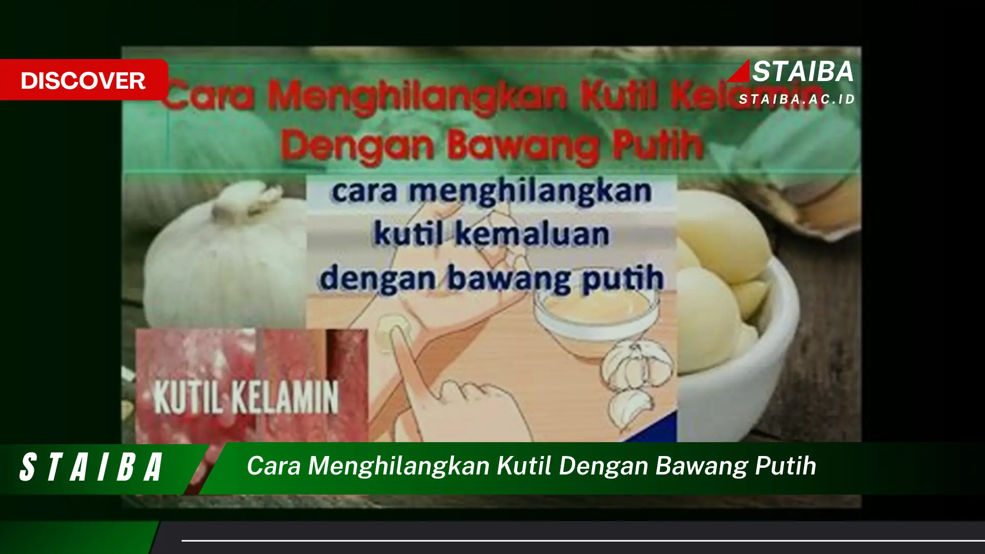 cara menghilangkan kutil dengan bawang putih