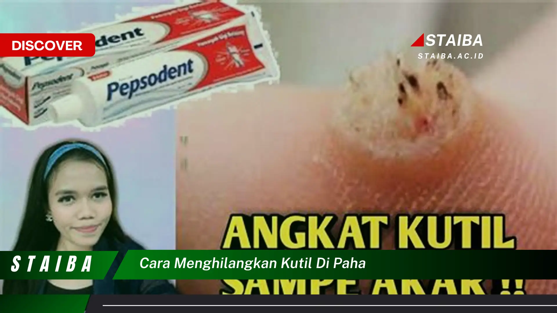 cara menghilangkan kutil di paha