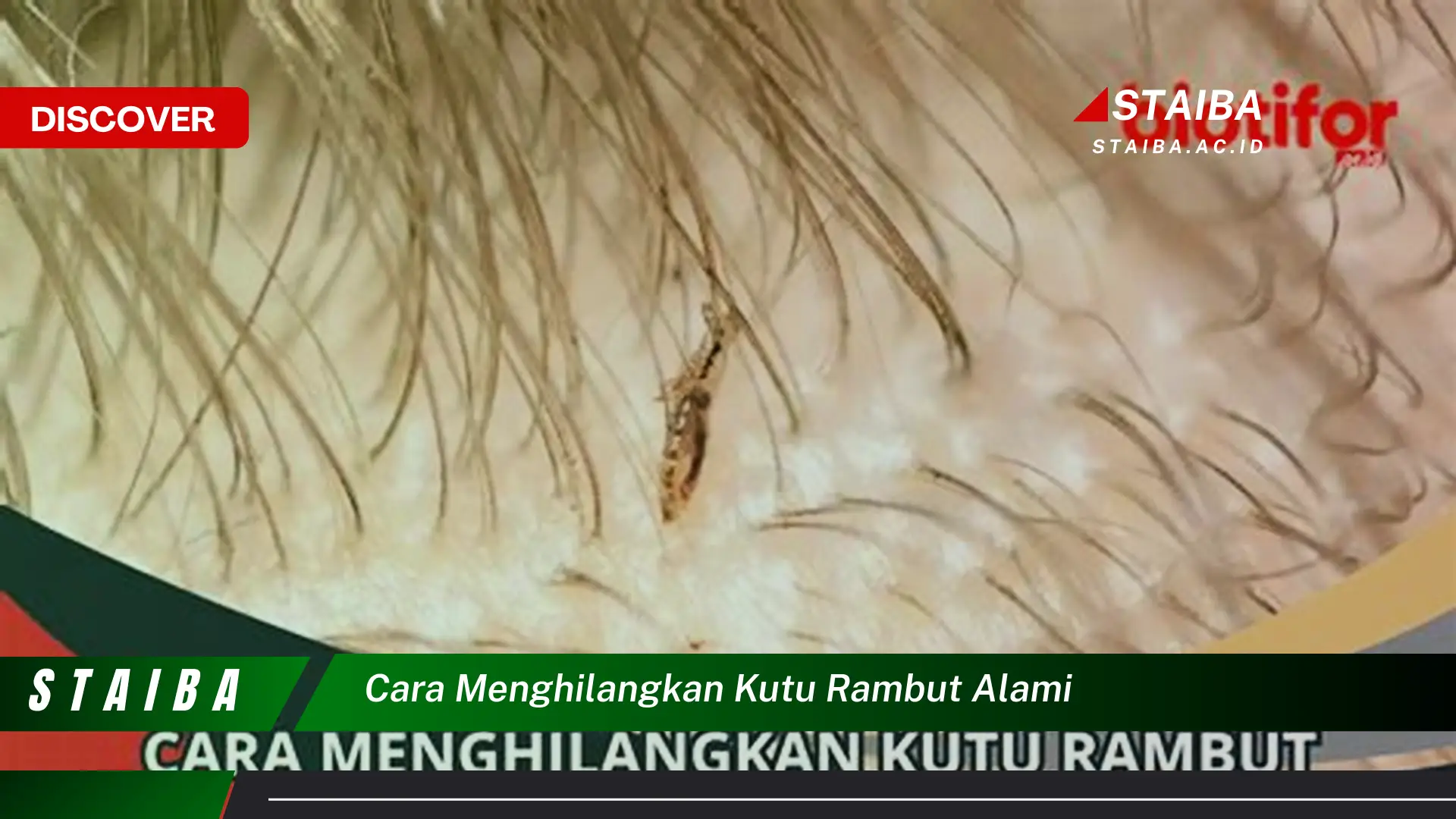 Ketahui Cara Menghilangkan Kutu Rambut Secara Alami yang Sudah Terbukti