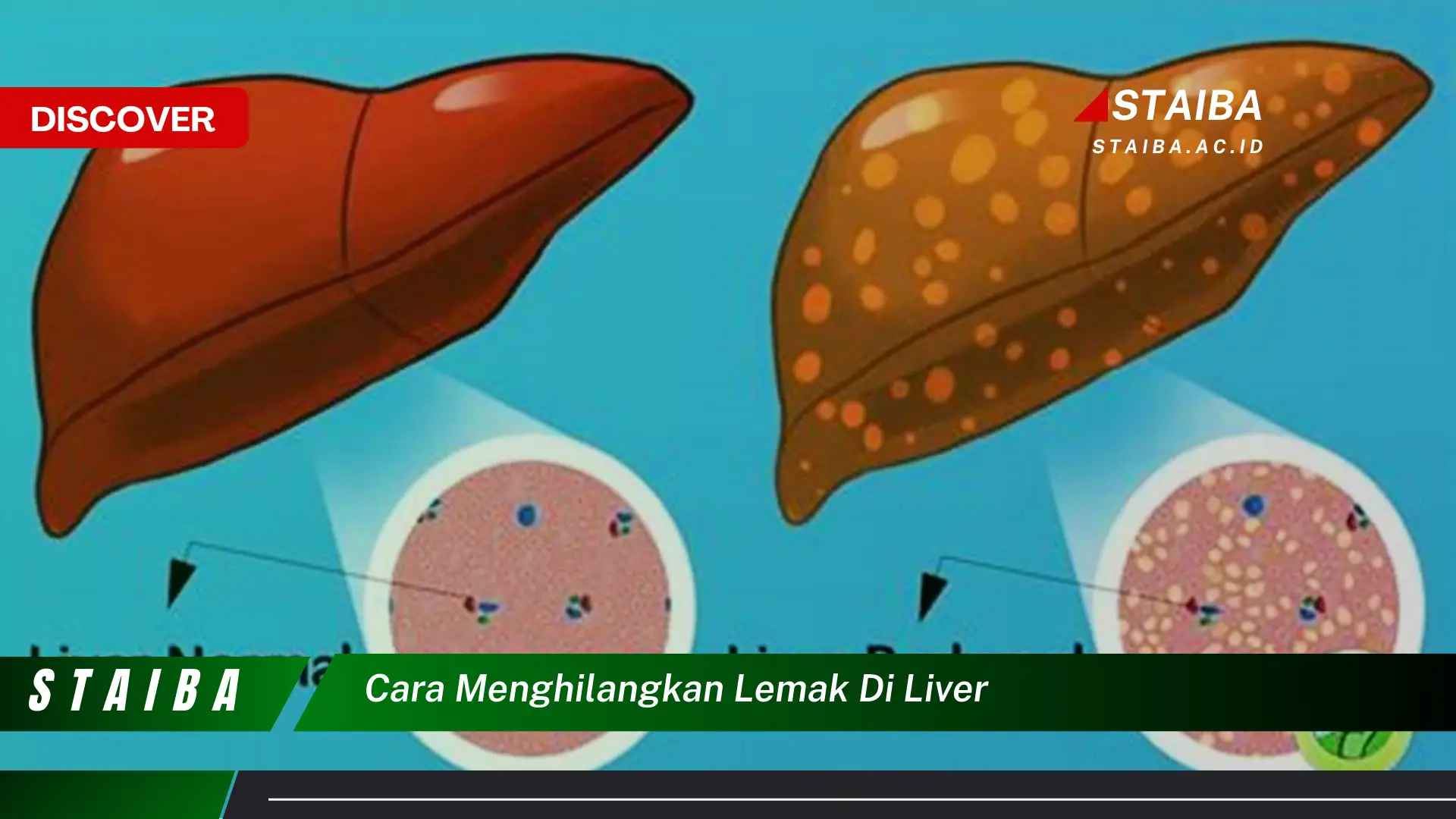 cara menghilangkan lemak di liver