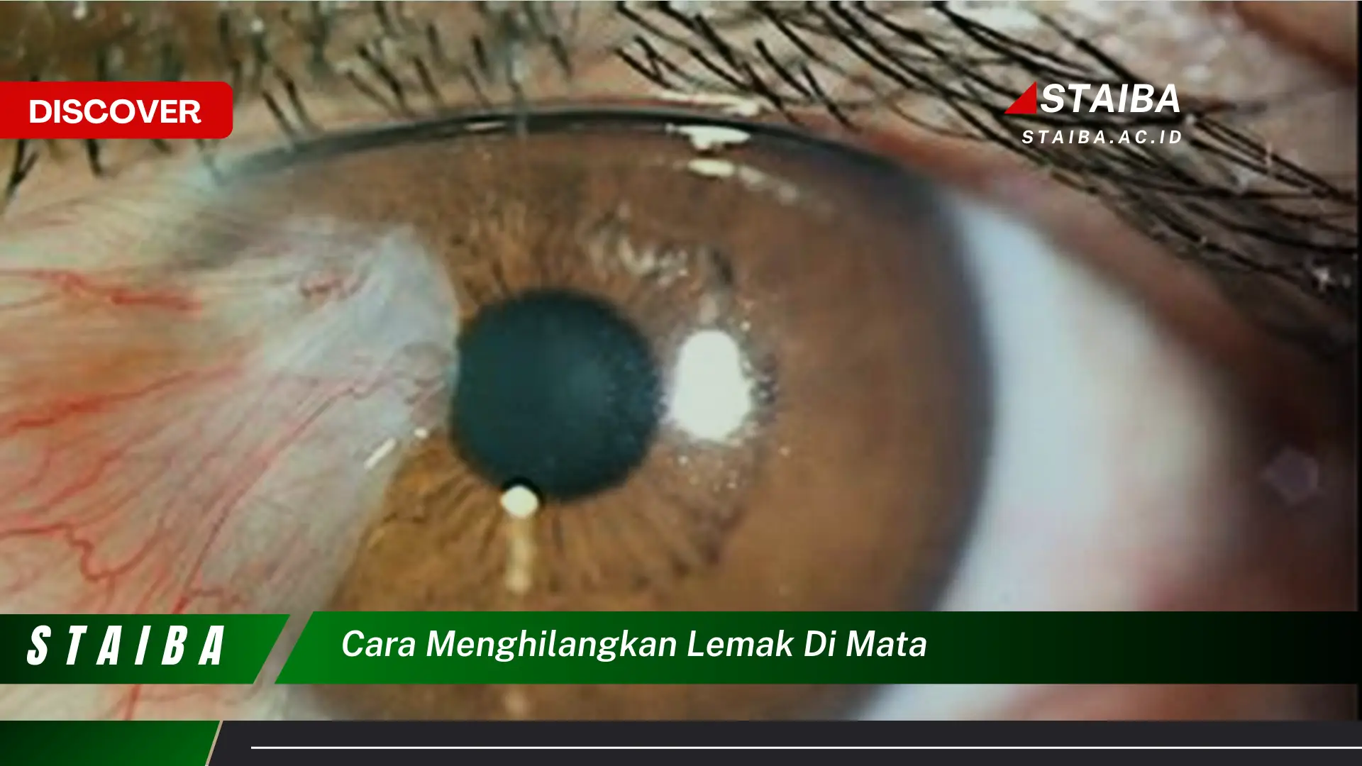 cara menghilangkan lemak di mata
