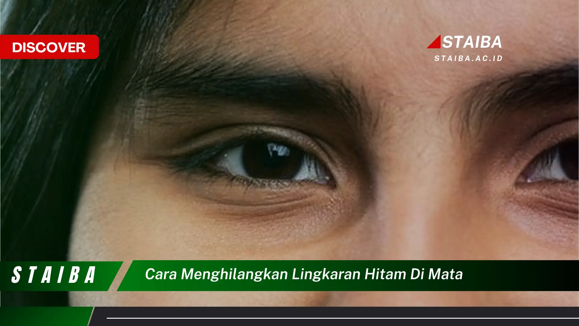 cara menghilangkan lingkaran hitam di mata