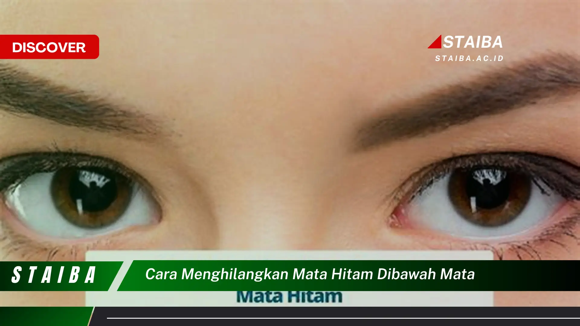 cara menghilangkan mata hitam dibawah mata