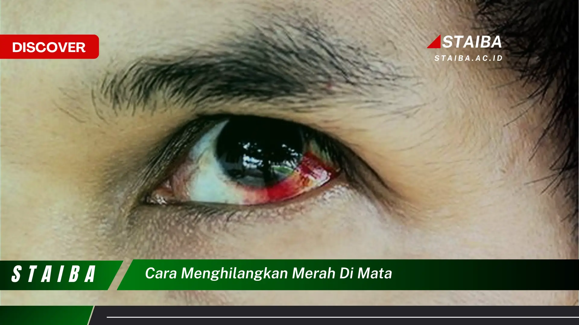 cara menghilangkan merah di mata