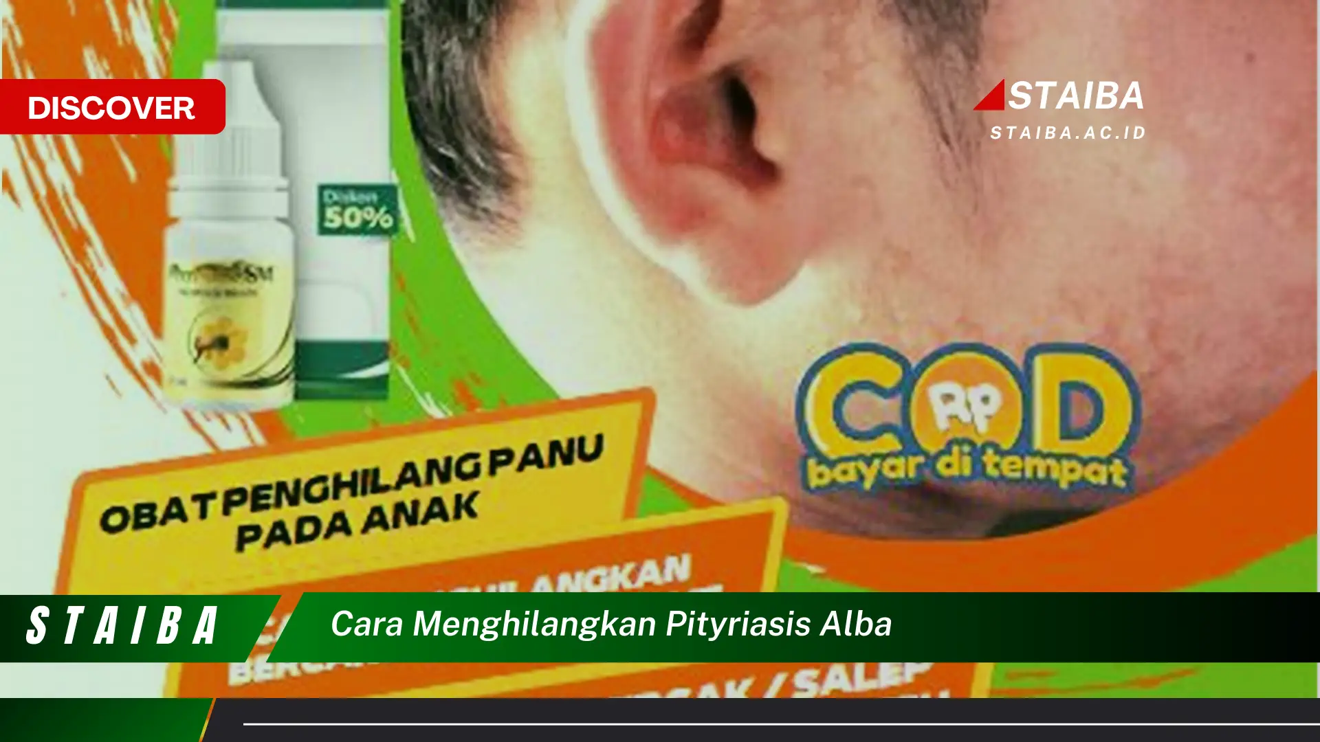 cara menghilangkan pityriasis alba cara menghilangkan pityriasis alba