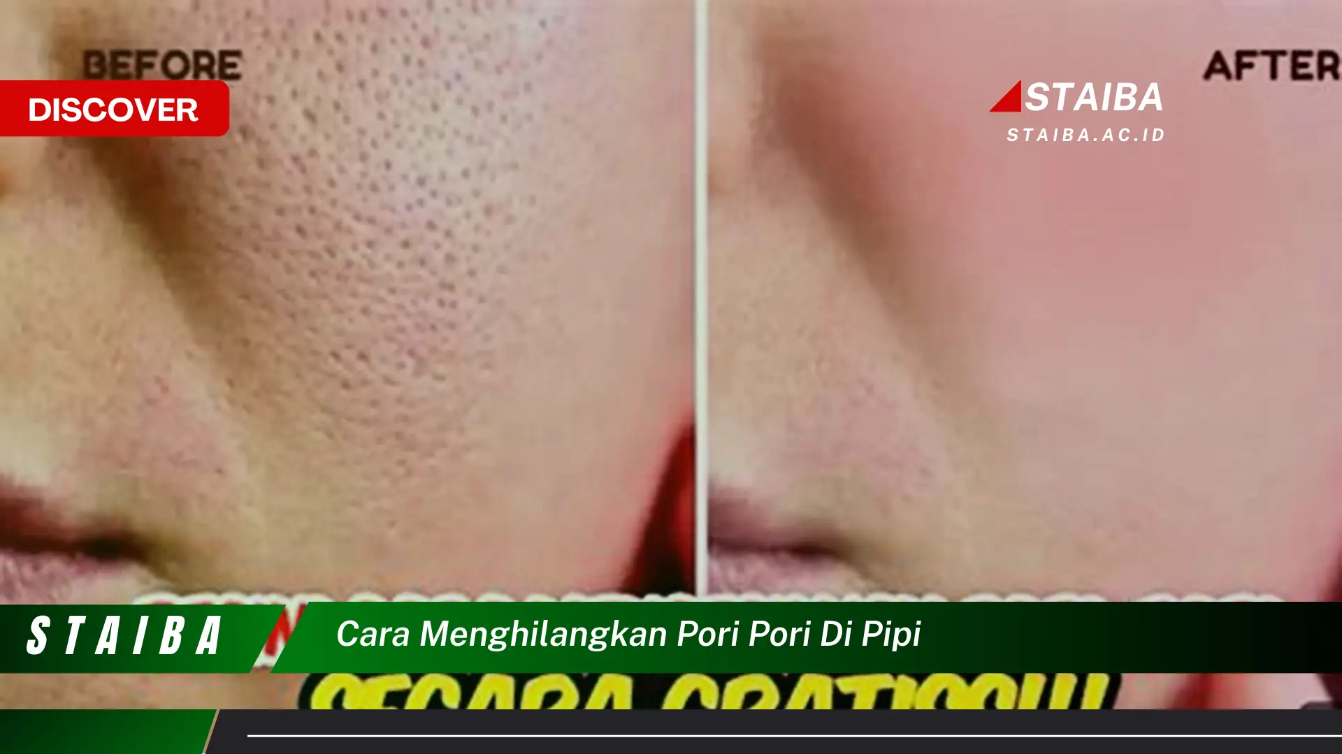 cara menghilangkan pori pori di pipi