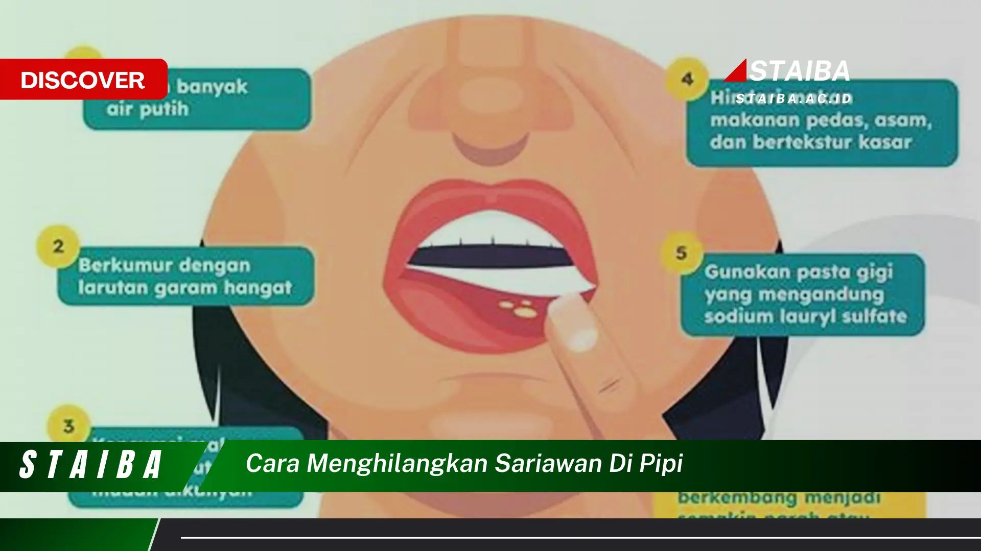 cara menghilangkan sariawan di pipi