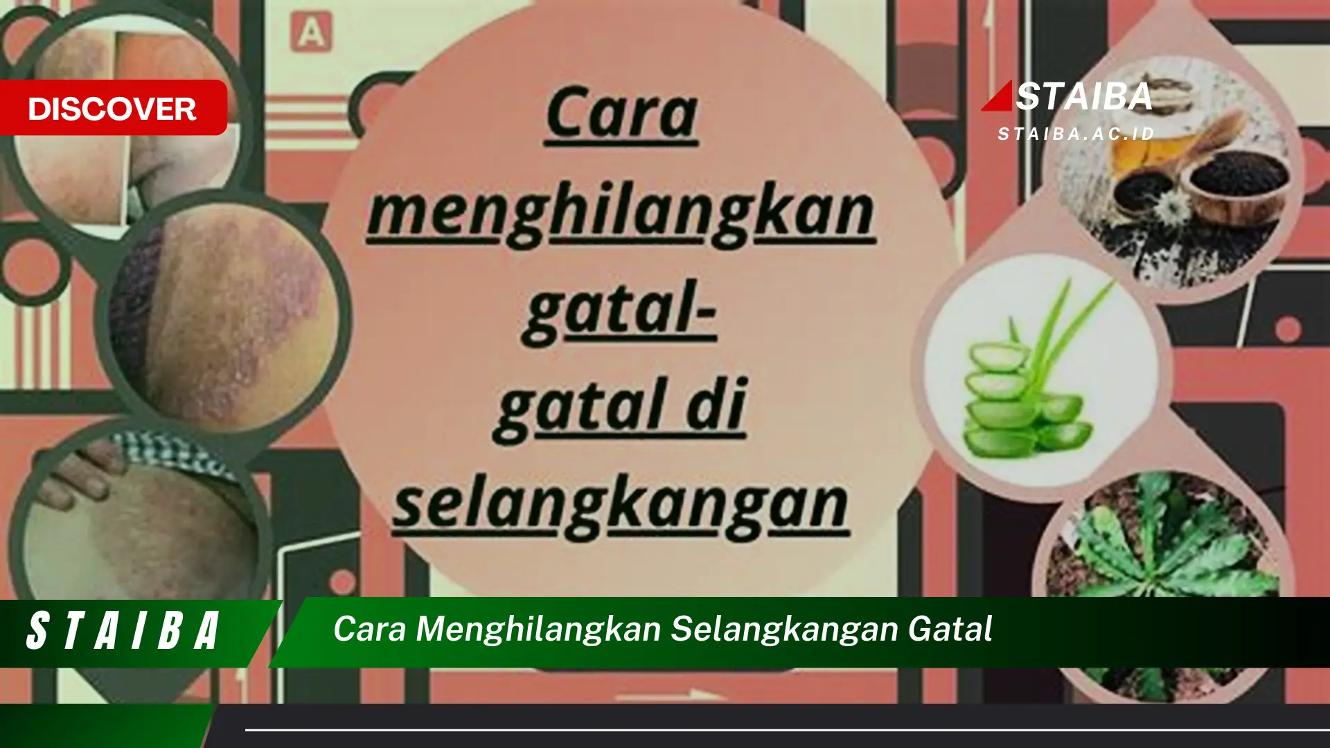 cara menghilangkan selangkangan gatal