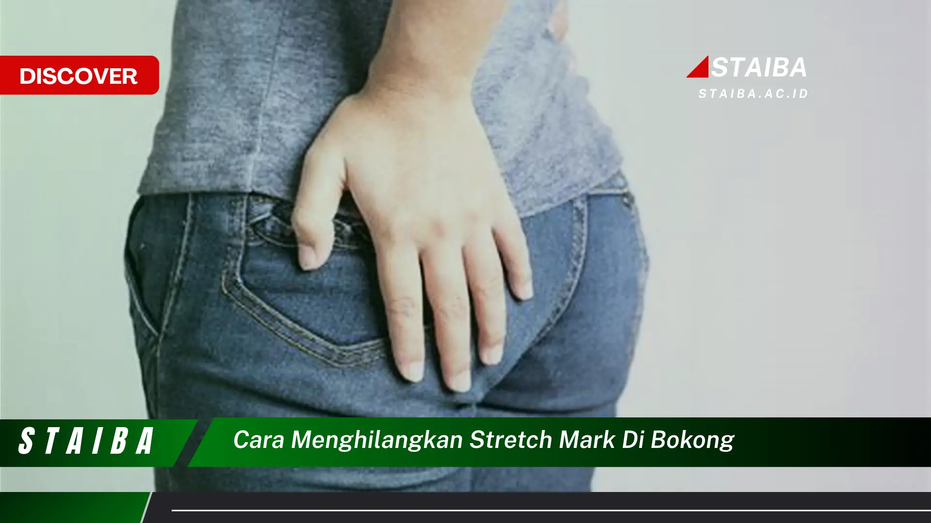 cara menghilangkan stretch mark di bokong